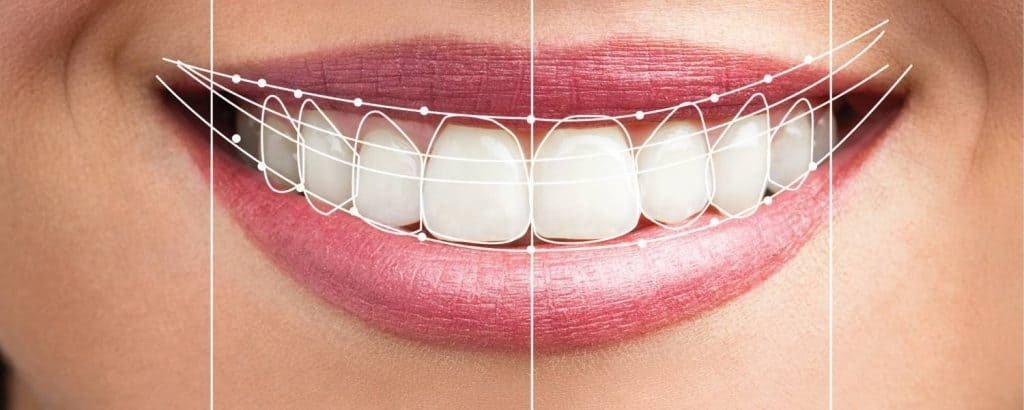 Escaneo digital dental