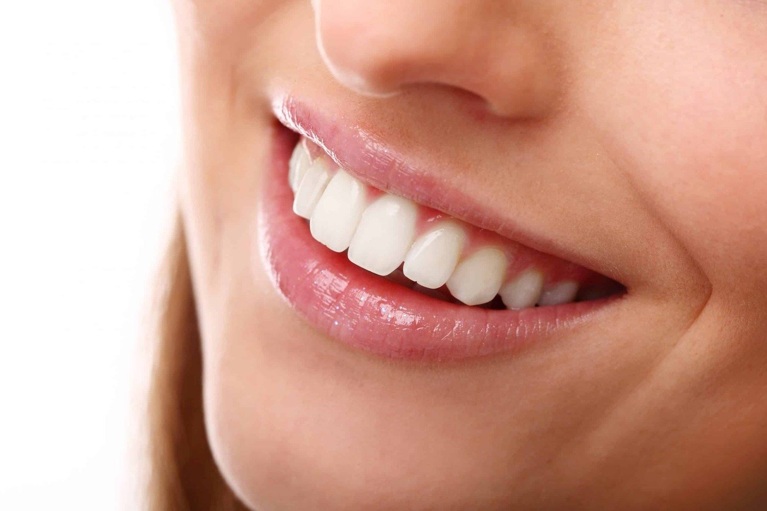 Diseño de sonrisa completo